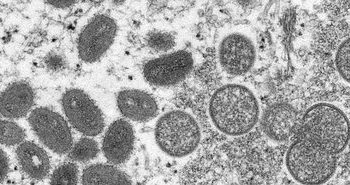 سویه خطرناک‌تر «آبله میمونی» در چه کشورهایی شناسایی شده است؟