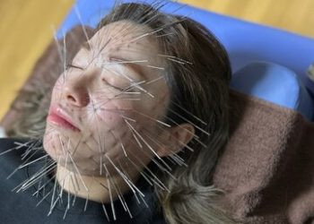 عجیب و غریب؛ روش جدید استفاده از طب سوزنی در ژاپن/ عکس