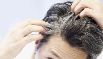 بهترین ویتامینها برای جلوگیری از ریزش مو