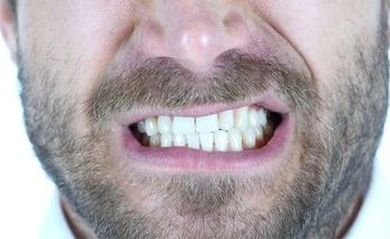 ویتامینهایی که کمبودشان سبب پوسیدگی دندان میشود