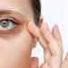 علت تیرگی دور چشم چیست؟/ ۵ ویتامین برای رفع چروک و سیاهی دور چشم