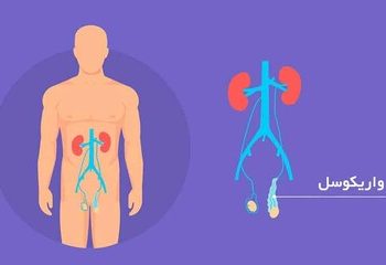 توضیحات دکتر سلمان اسلامی درباره یک عمل جراحی مردانه