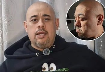 مردی که با چشمان از حدقه بیرون‌زده رکوردهای گینس را جابه‌جا کرد/ عکس