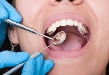 تأثیر استرس بر سلامت دهان و دندان
